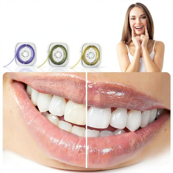 Dental Sanding Strips by bopika Coarse Medium Fine Rolls-2