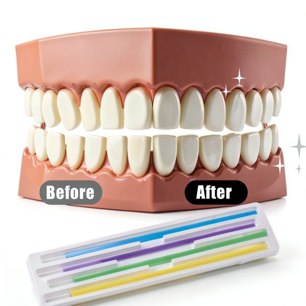 Qianyu Dental Sanding Strips 60pcs Resin Polishing Kit ColorCoded-4